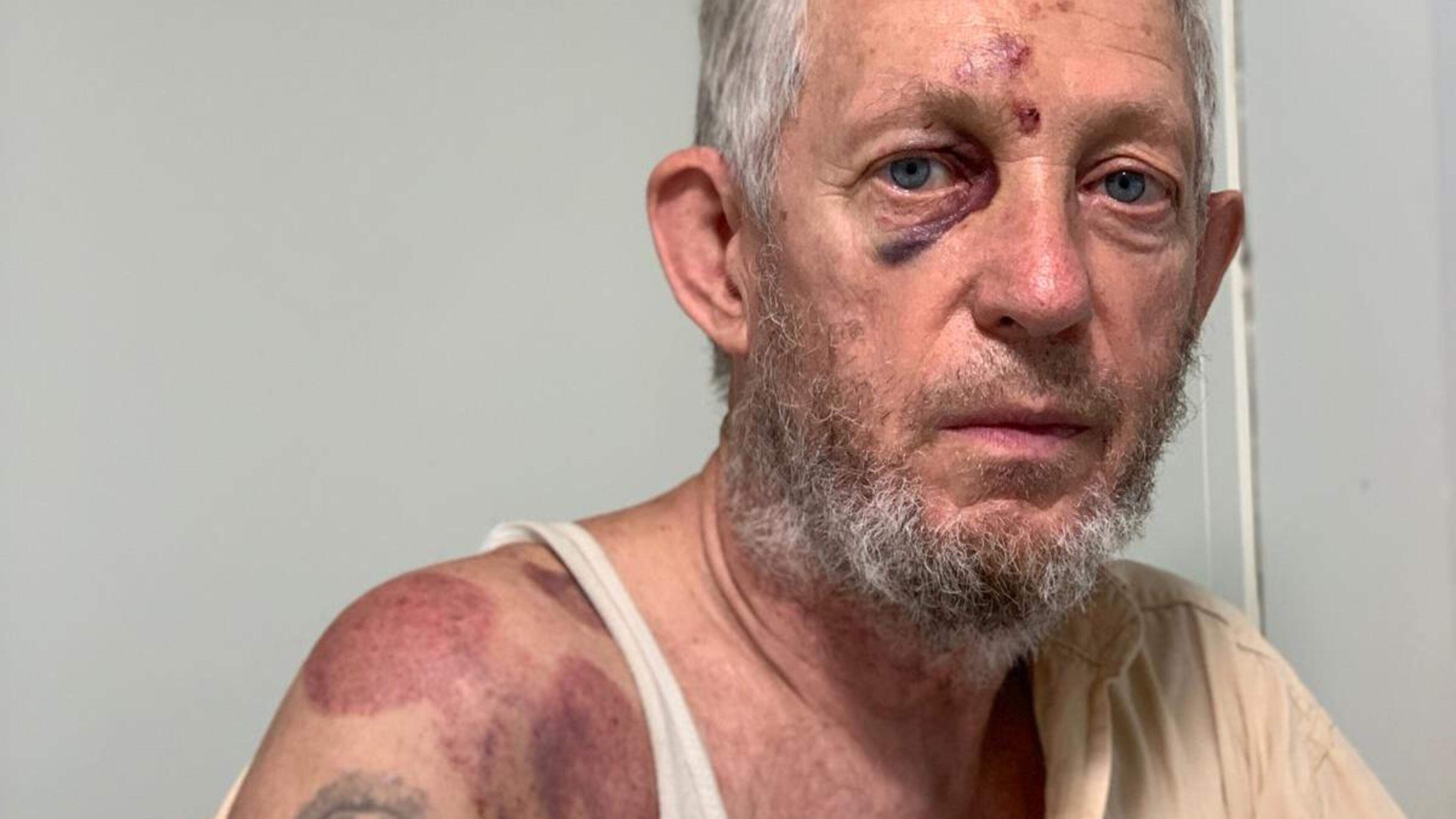 Vladimir (67) krijgt klappen op voorterrein in Ter Apel. Kabinet wil buitenblijvers niet meer op het